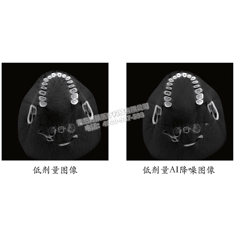 V|ǻCBCT ǻȫCخa(chn)ƷB